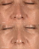 Dermalogica Pro Melanopro Peel System - Global Beauty Supply, LLC