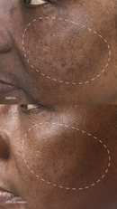Dermalogica Pro Melanopro Peel System - Global Beauty Supply, LLC