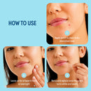 Kiss New York Spot Care Retinol Clear Patch (48 Patches)
