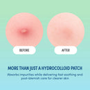 Kiss New York Happy Skin Colorful Spot Pach (48 Patches)